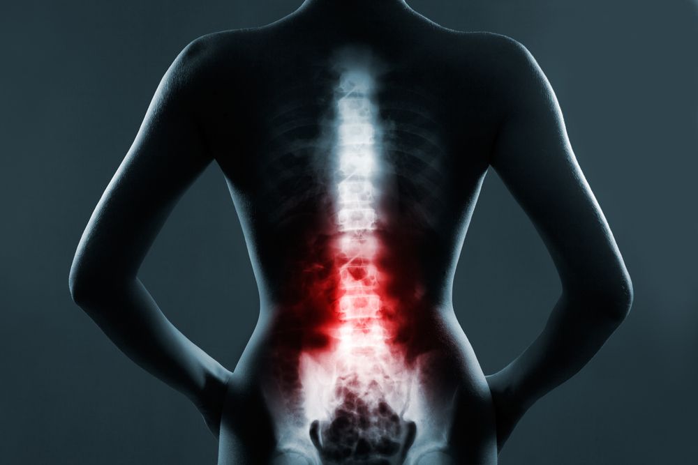 Spinal Cord Injury