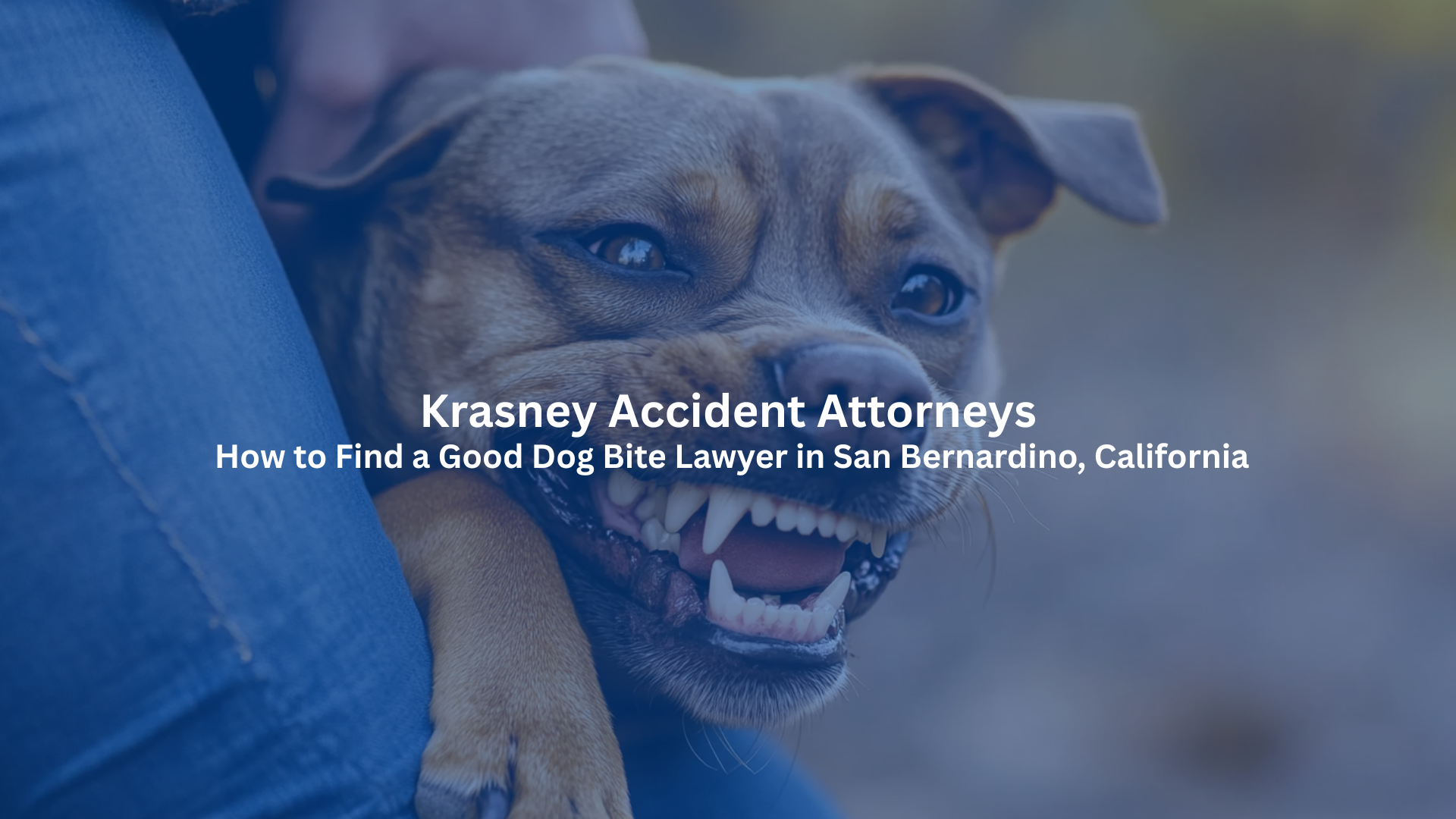 San Bernardino Dog Bite Lawyer 