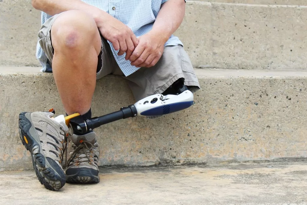 man sitting with prosthetic leg