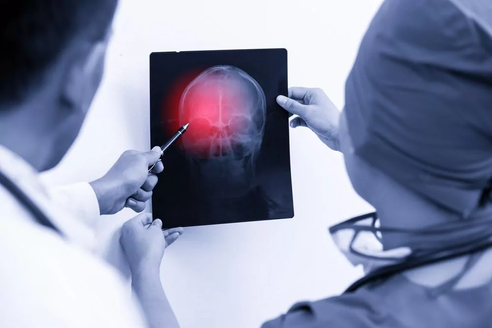 doctors examining t-bone accident x-ray