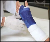 So Cal Fracture Injury Attorney