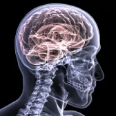 Grand Terrace Brain Injury Attorney